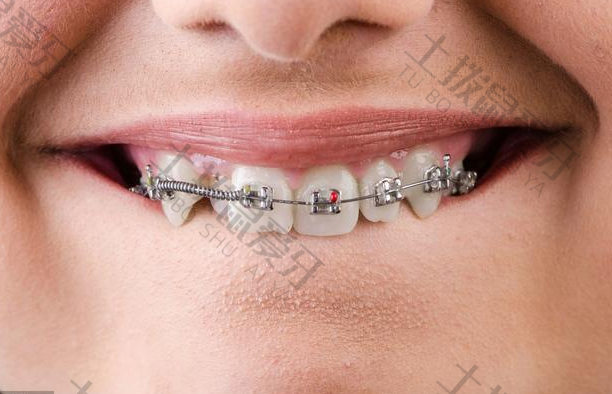 矫正牙龈萎缩怎么恢复正常吗