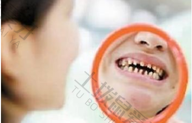 牙齿稀疏怎么整牙