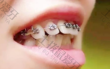 儿童牙齿早期干预矫正费用
