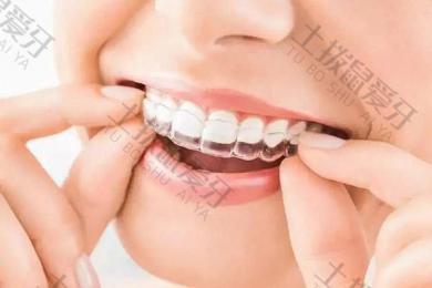 牙齿稀疏整牙难吗 牙齿稀疏矫正几个月可以看见效果