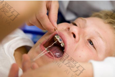 儿童牙齿早期干预矫正有几种 