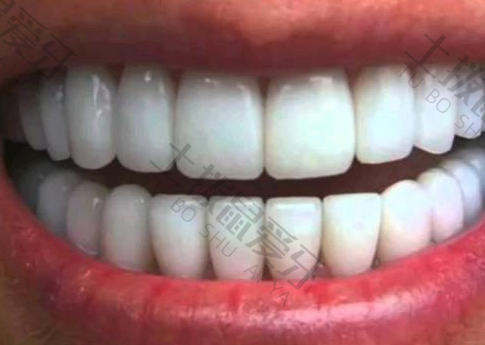牙齿稀疏矫正需要多长时间