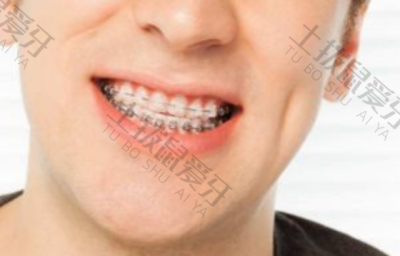 牙齿稀疏矫正原理是什么 牙齿稀疏矫正过程