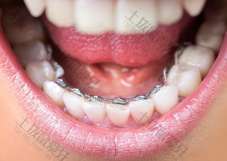 牙齿畸形矫正的最佳时期是什么时候