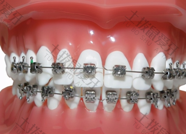 牙齿畸形矫正的最佳时期是什么时候