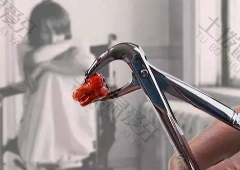为什么拔牙后一直流血