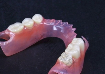 活动假牙用哪种基托舒服 活动义齿对两边真牙有伤害吗