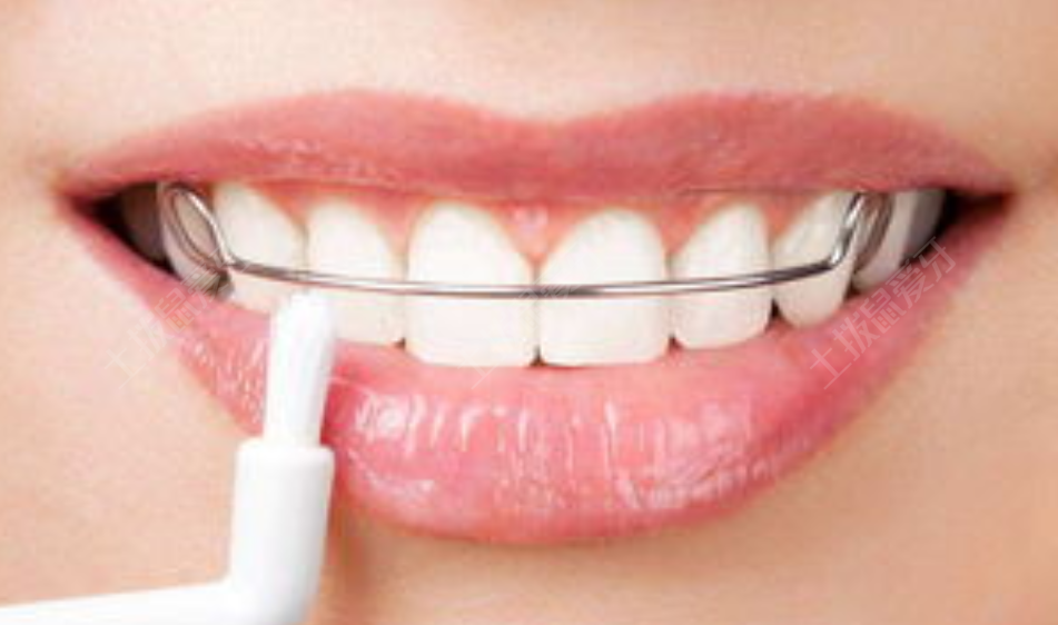 儿童牙齿地包天需要矫正吗