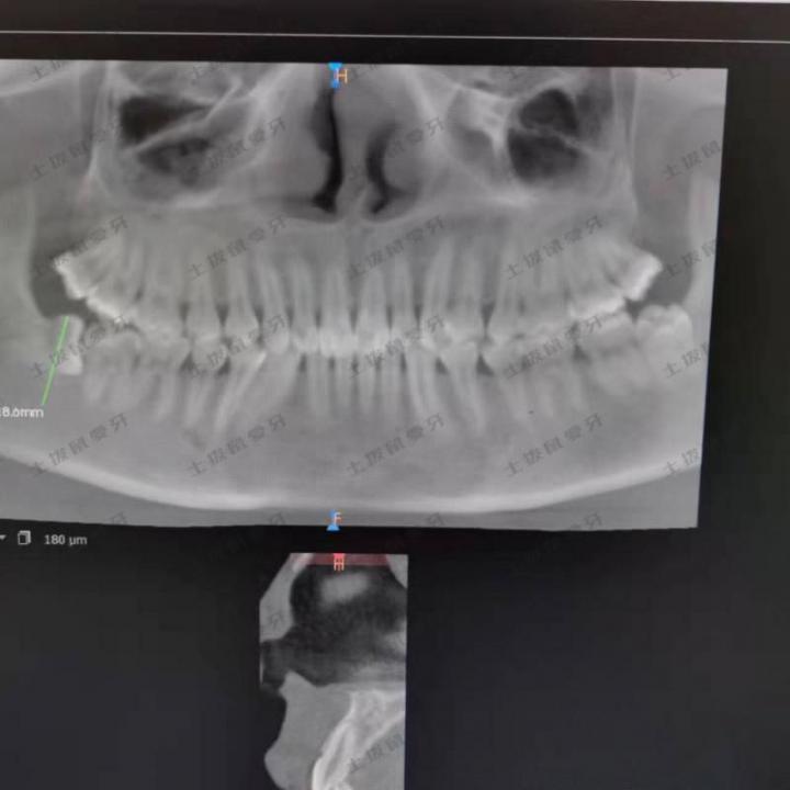 点评
