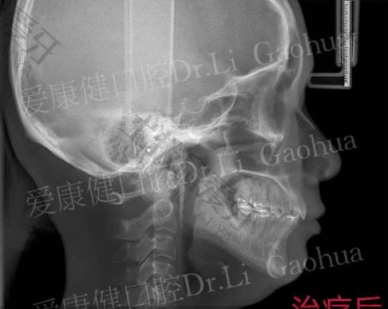 点评