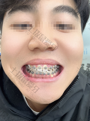 点评